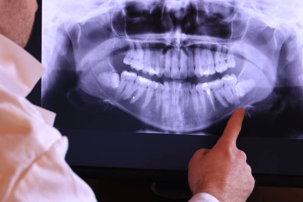 Best Emergency Treatment for Dental Infections or Abscesses in Glen Burnie, MD