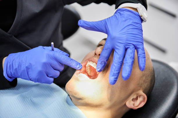 Best Emergency Tooth Extraction in Glen Burnie, MD
